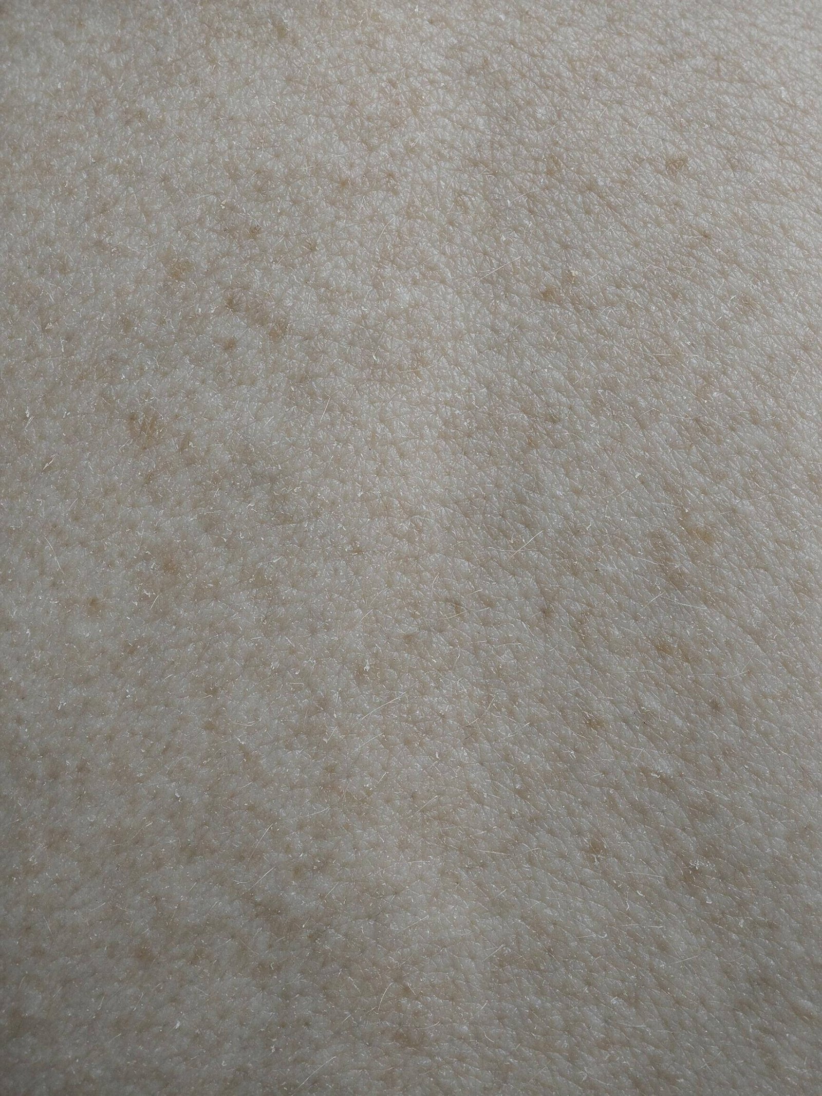 Macro skin texture, uneven and dull